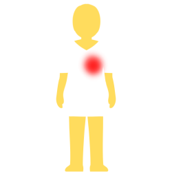 A person with no hair or face, an emoji yellow skintown, and a white pair of shorts and pants with no visible divider between the two. there's a glowing red spot on their right chest.